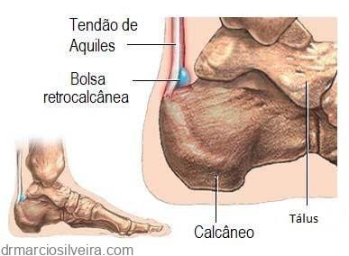 unguent bun pentru artroza genunchiului tratament fizic pentru artroză