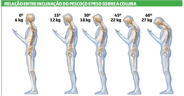 Dr. Márcio Silveira: Ortopedista Especialista em Traumatologia Esportiva, Joelho - Adulto e Infantil - e Idoso inclinicacao do pescoco e problemas na coluna