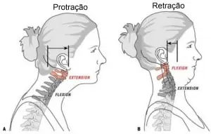 Dr. Márcio Silveira: Ortopedista Especialista em Traumatologia Esportiva, Joelho - Adulto e Infantil - e Idoso retracao cervical