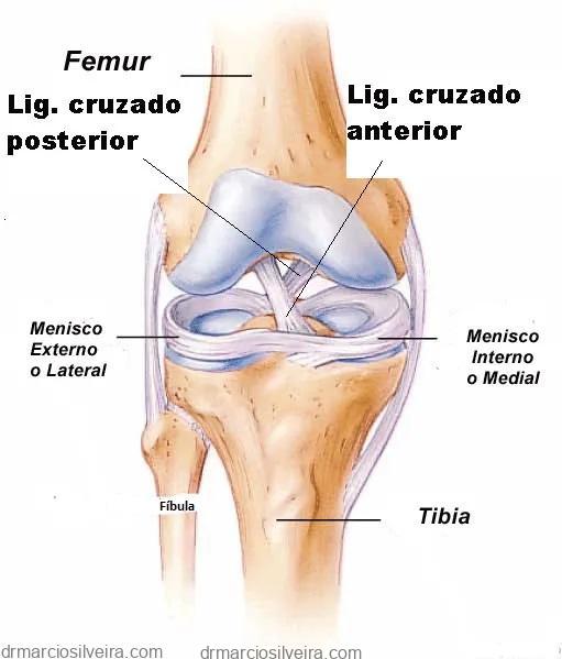 Dr. Márcio Silveira: Ortopedista Especialista em Traumatologia Esportiva, Joelho - Adulto e Infantil - e Idoso ligamento cruzado menisco