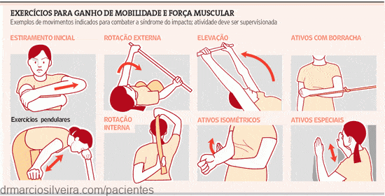 Discinesia, Ganho De Mobilidade E Fortalecimento Da Cintura Escapular E  Ombro - Dr. Márcio Silveira