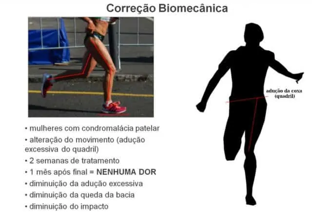 Dr. Márcio Silveira: Ortopedista Especialista em Traumatologia Esportiva, Joelho - Adulto e Infantil - e Idoso Correcao Biomecanica Resolve Condromalacia